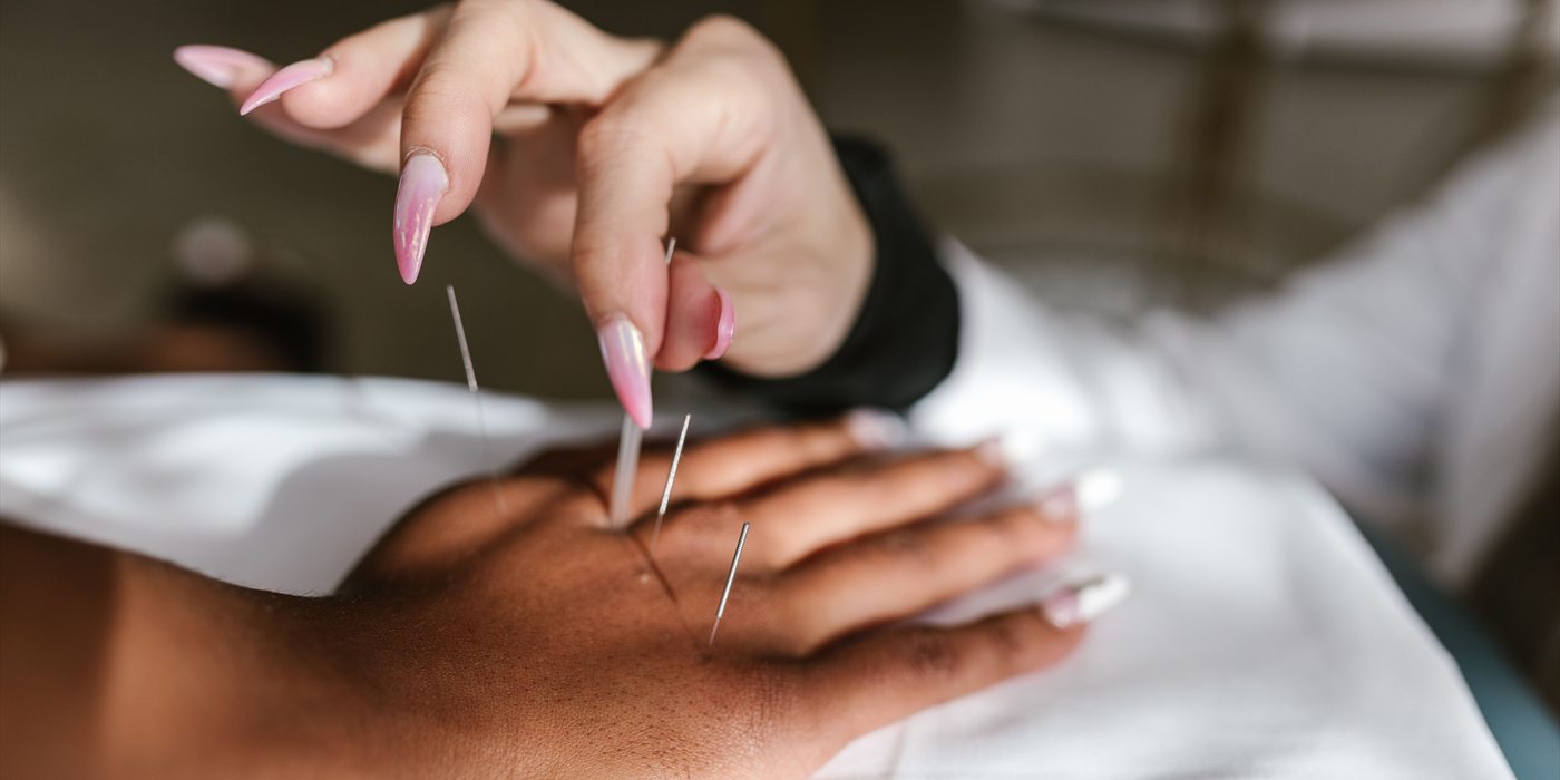 Acupuncture at Motion Crafters in Airdrie