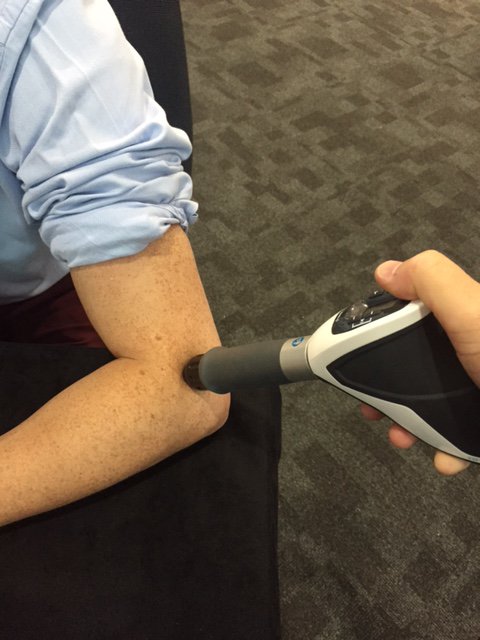 Shockwave applicator used to treat the elbow